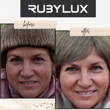 Red Light Therapy Before and After Photos