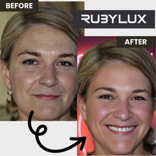 Red Light Therapy Before After Photos