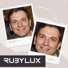 Red Light Therapy Before After Photos of a Man